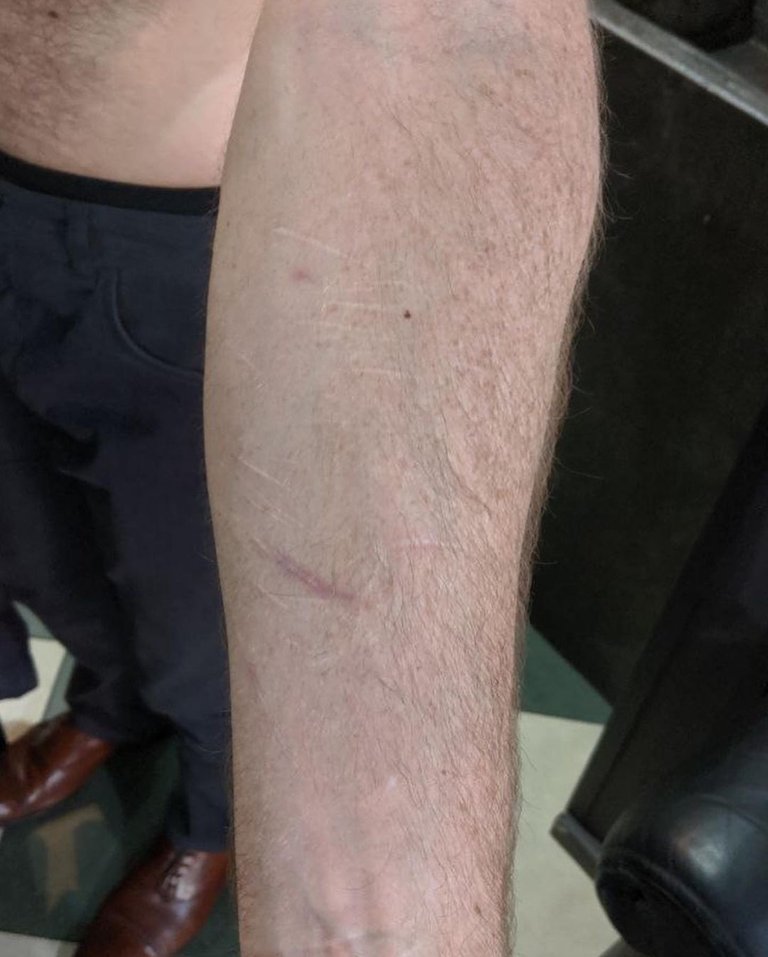 Scar`s work sample 0